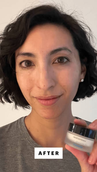 Pai after applying the SkinCeuticals A.G.E Advanced Eye